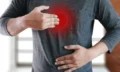 acid-reflux