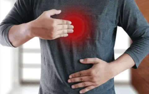acid-reflux