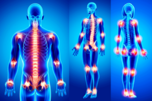 Ayurveda management for Arthritis